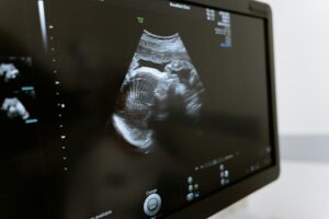 Новые выплаты в 2025 году: максимальное пособие по беременности и родам составит 1,1 млн рублей